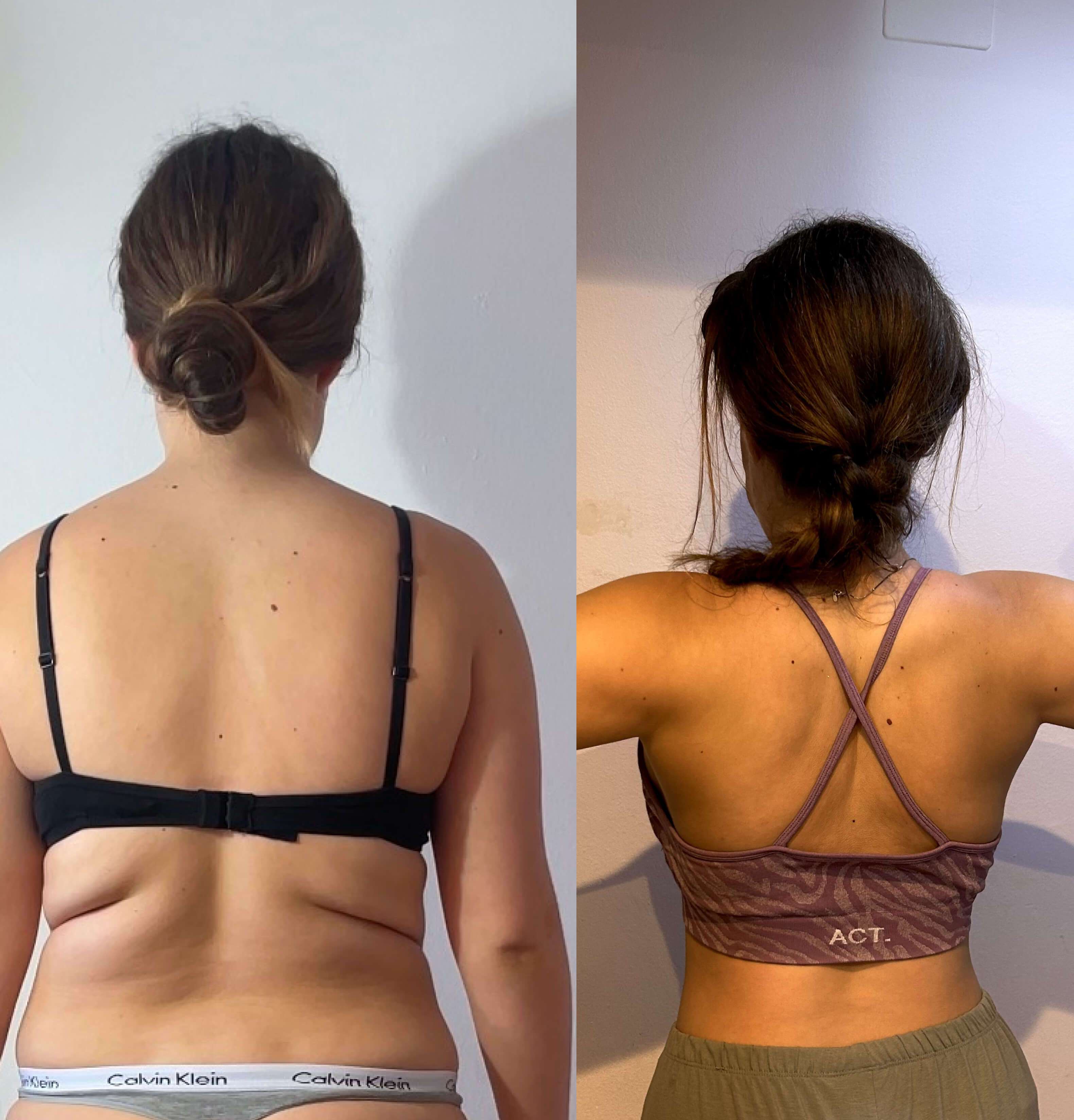 Maria, six months on tirzepatide